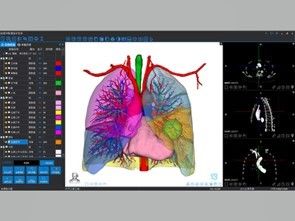 Serviços de reconstrução 3D médica e impressão 3D